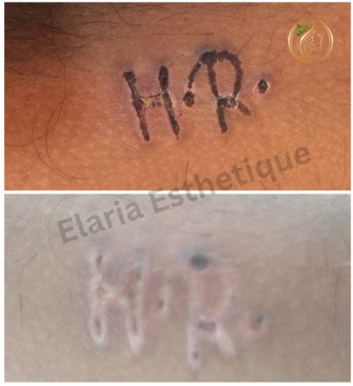 Elaria Esthetique — Feel Beautiful. Be Elaria